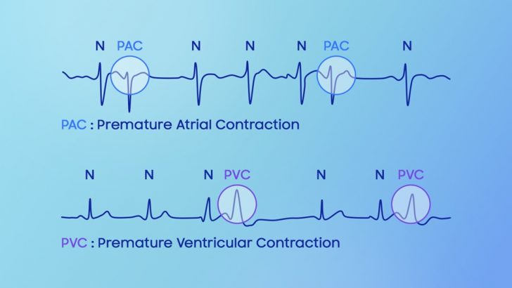 Samsung-Mobile-Galaxy-Watch8-series-sensor-preventative-care-Vascular-Load-Antioxidant-Index_main2-Final.jpg