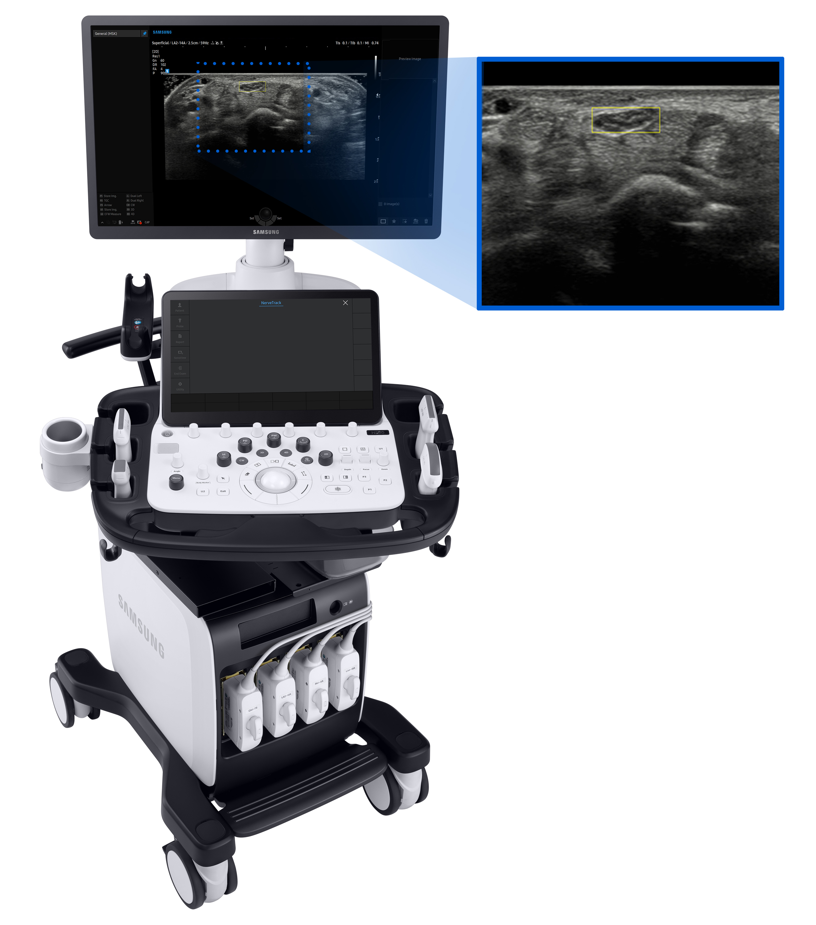 Samsung-Ultrasound-System-V8.jpg