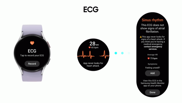 10_ECG.gif